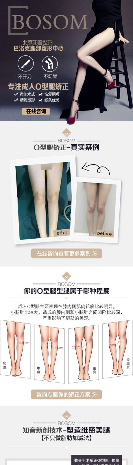 医疗美容腿型矫正整形隆鼻