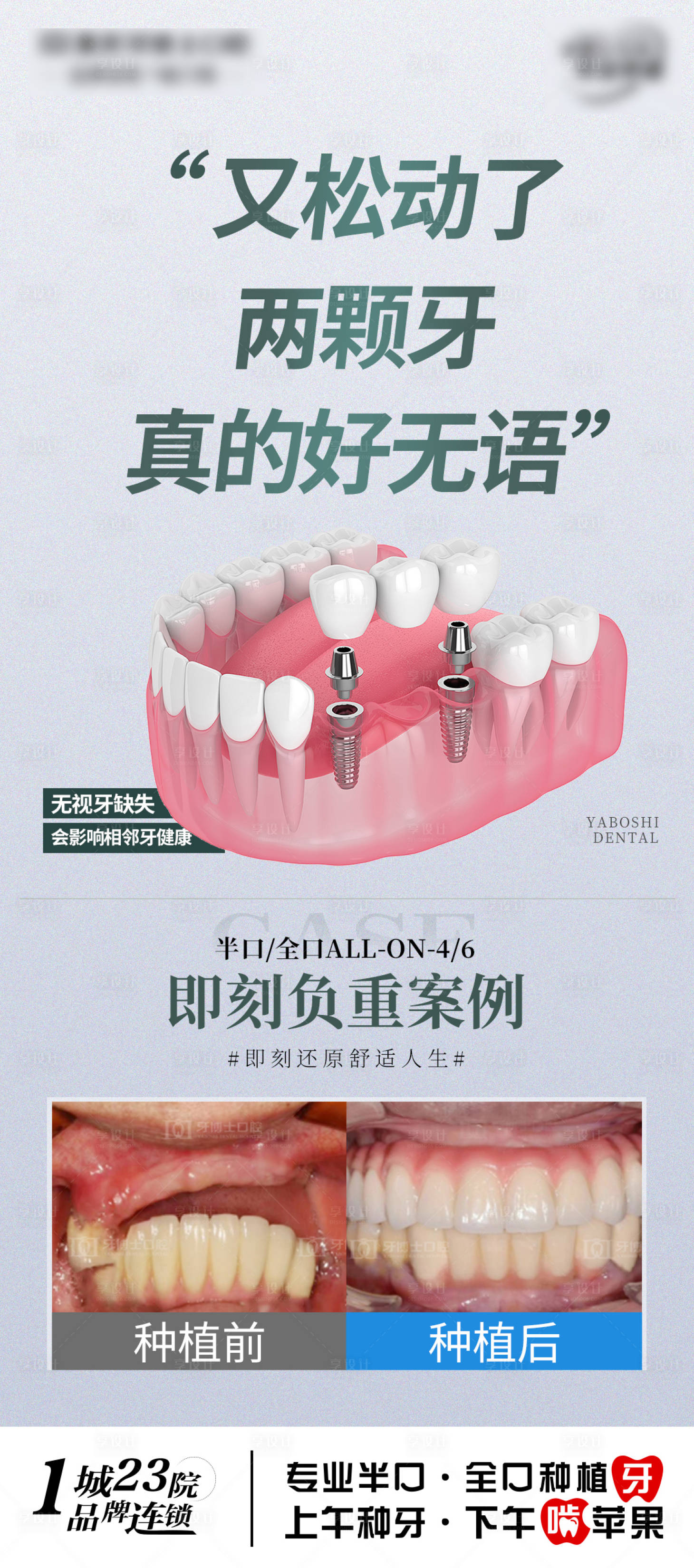 源文件下載【口腔種牙宣傳海報】編號：39260028754719410