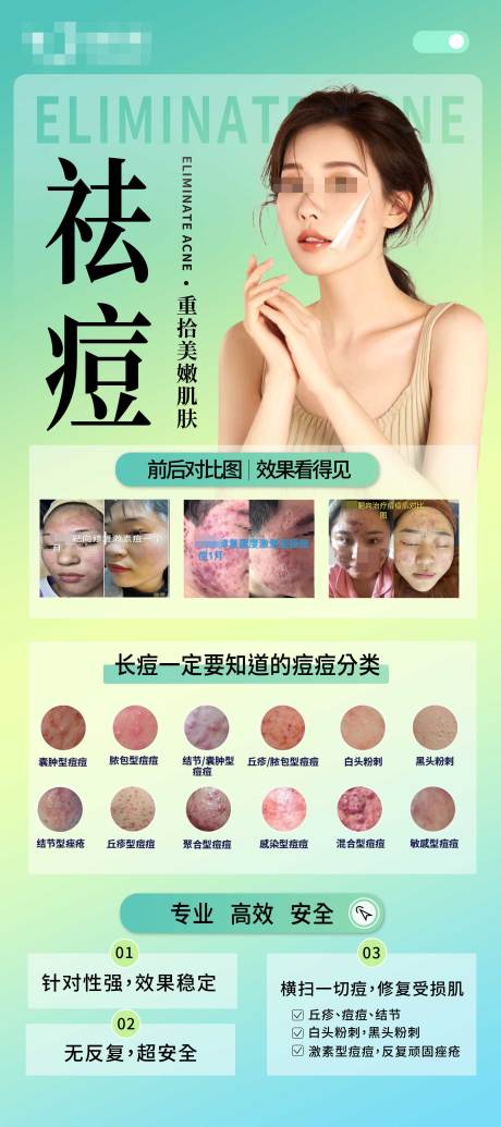 源文件下载【祛痘展架医美祛痘种类对比图海报】编号：70760028637081965