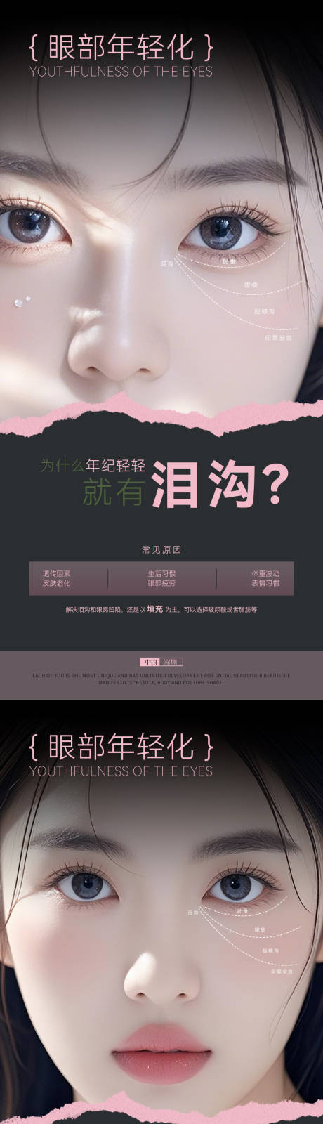 源文件下载【医美科普眼部】编号：25970029090375547