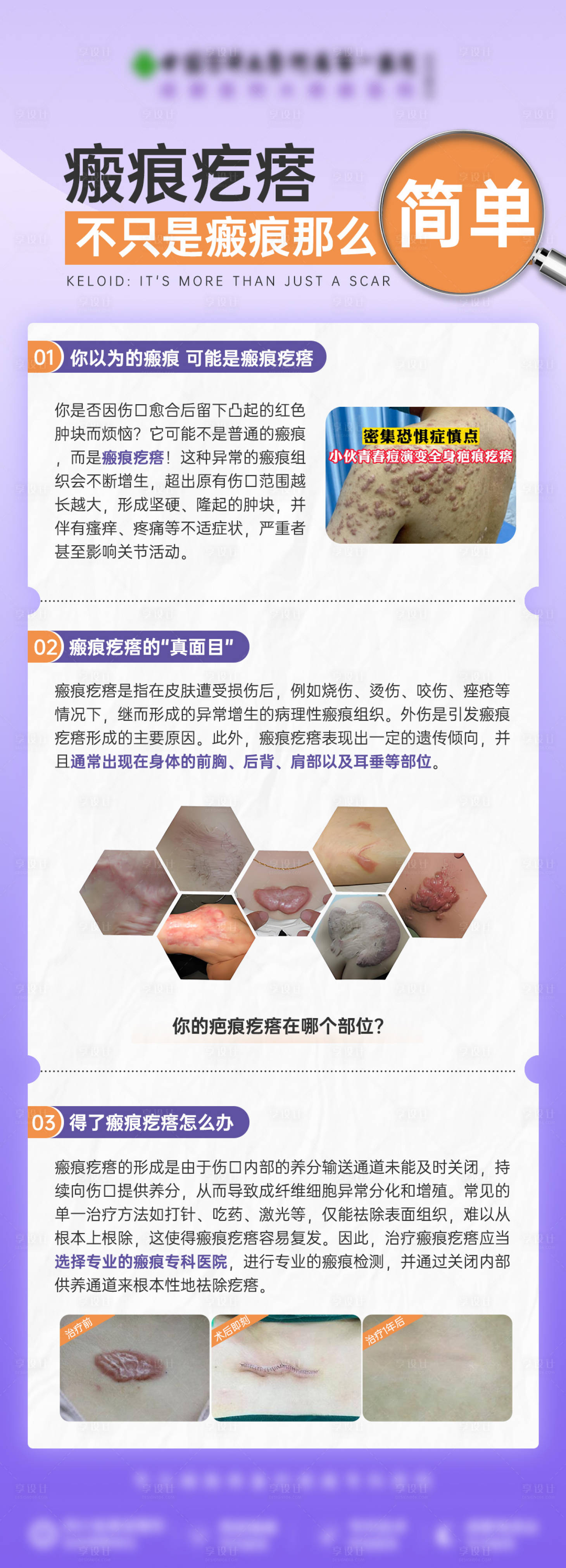 源文件下载【享设计】搜索编号：14290028976724132【科普】