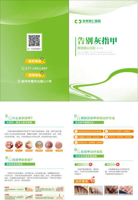 源文件下載【享設計】搜索編號：43750029036017681【灰指甲二折頁】