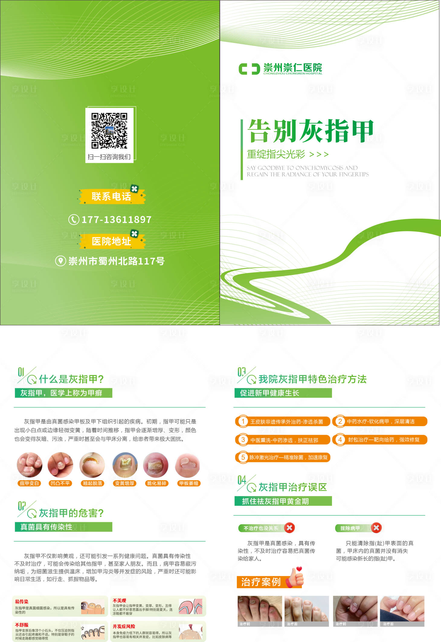 源文件下载【享设计】搜索编号：43750029036017681【灰指甲二折页】