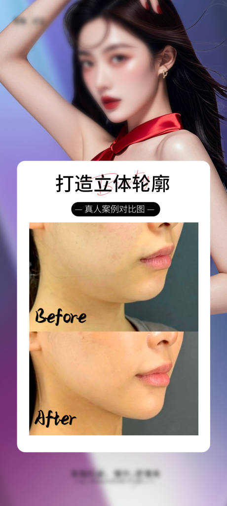 源文件下载【医美v脸海报】编号：87450028609757003
