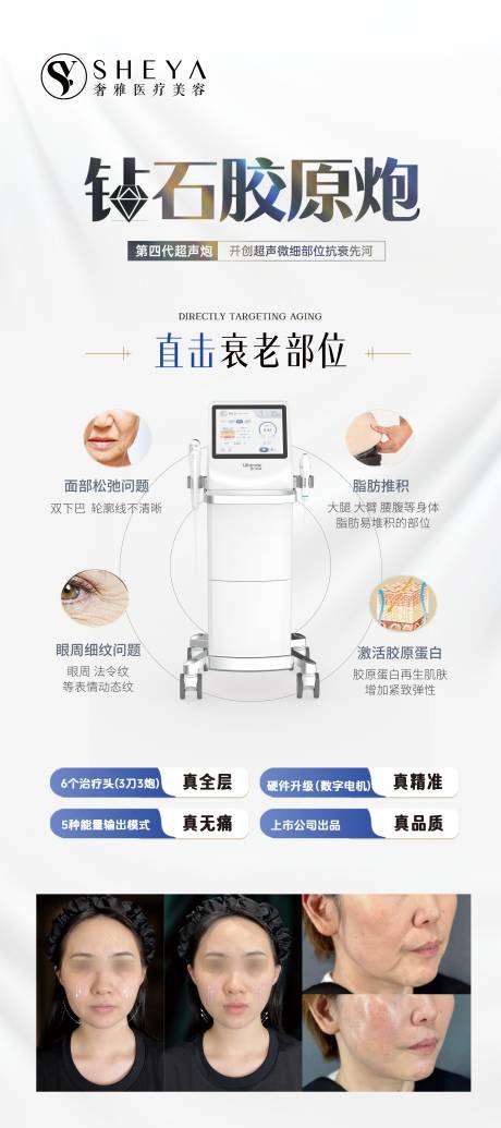 源文件下載【醫美儀器超聲V拉美超聲刀】編號：71550028875065551