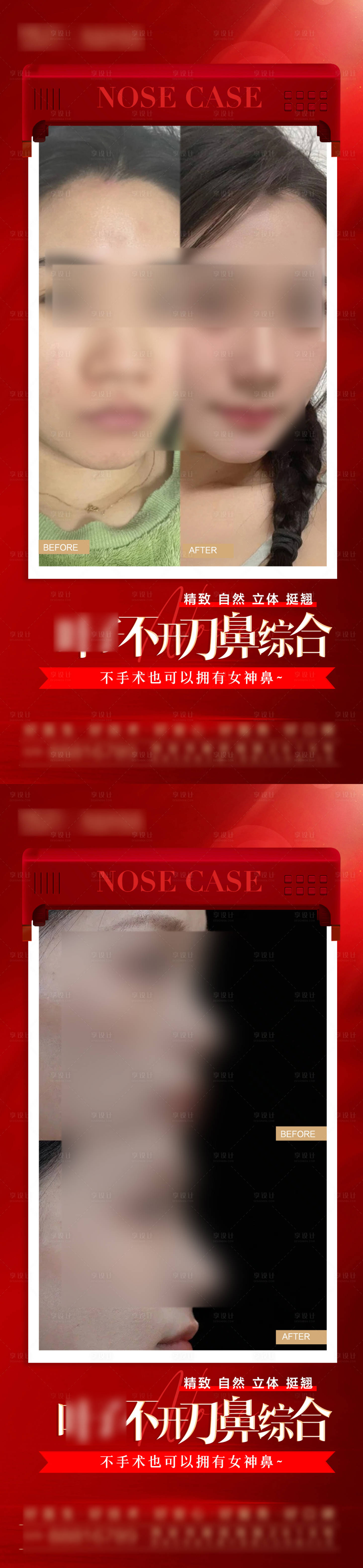 源文件下载【隆鼻鼻部案例海报】编号：84210028999347052