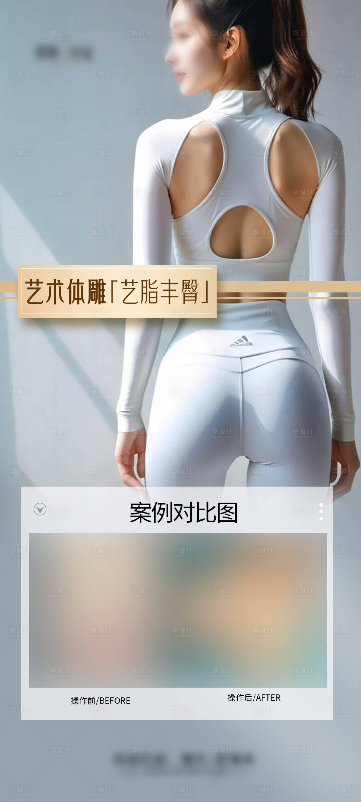 源文件下載【享設計】搜索編號：21840029023688663【醫美豐臀海報】