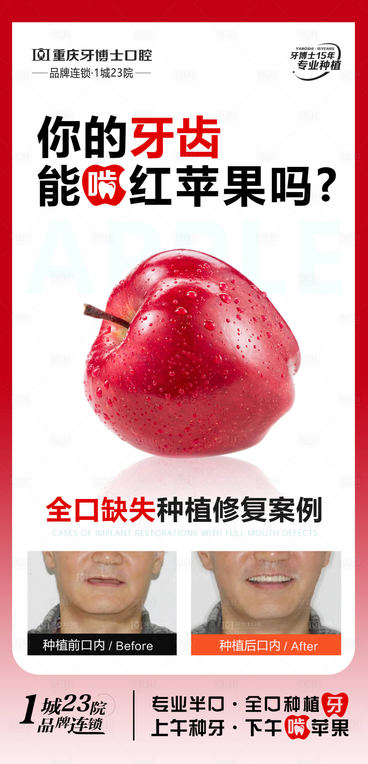 源文件下載【享設計】搜索編號：78080028847983126【口腔種牙宣傳海報】
