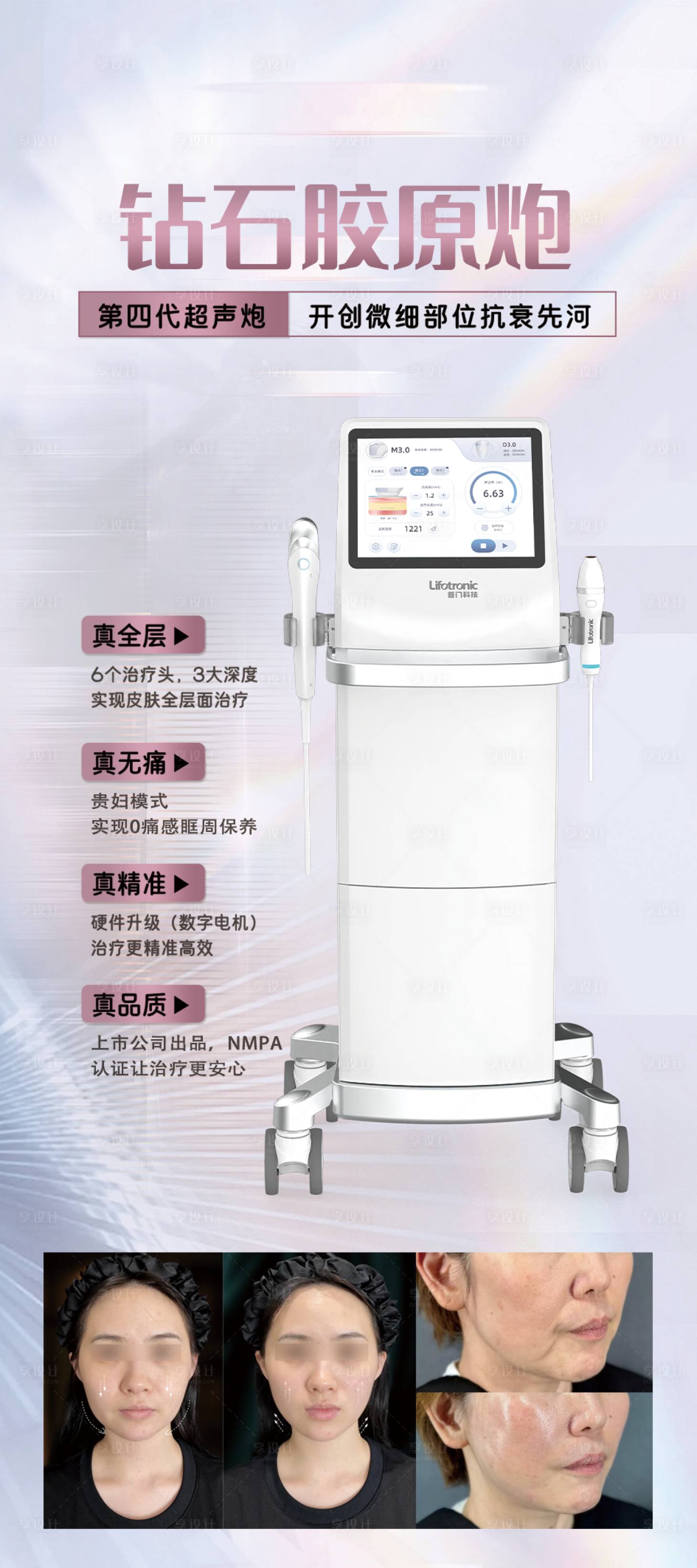 源文件下载【享设计】搜索编号：82530028877428461【钻石胶原炮海报】