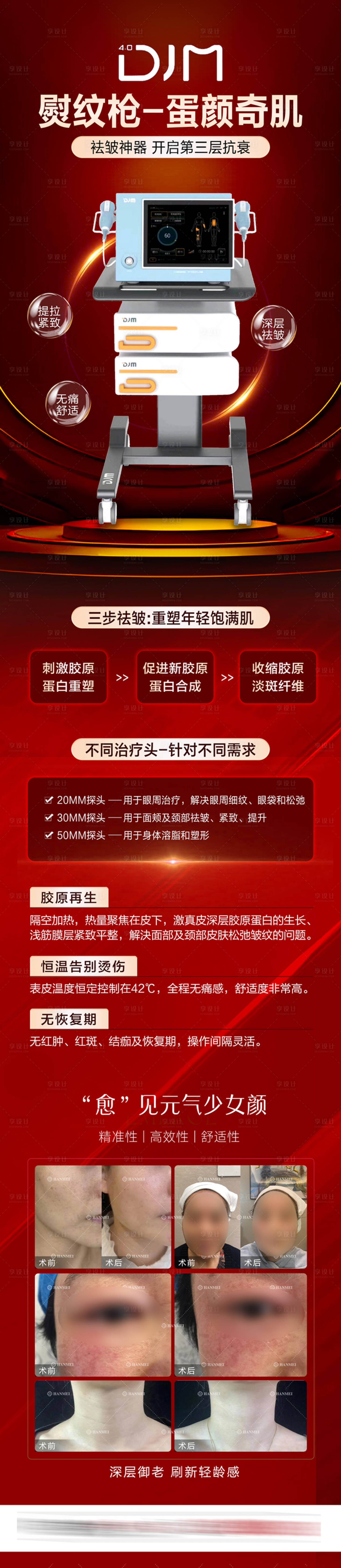 源文件下載【享設(shè)計(jì)】搜索編號(hào)：27810028819372518【醫(yī)美熨紋機(jī)海報(bào)】