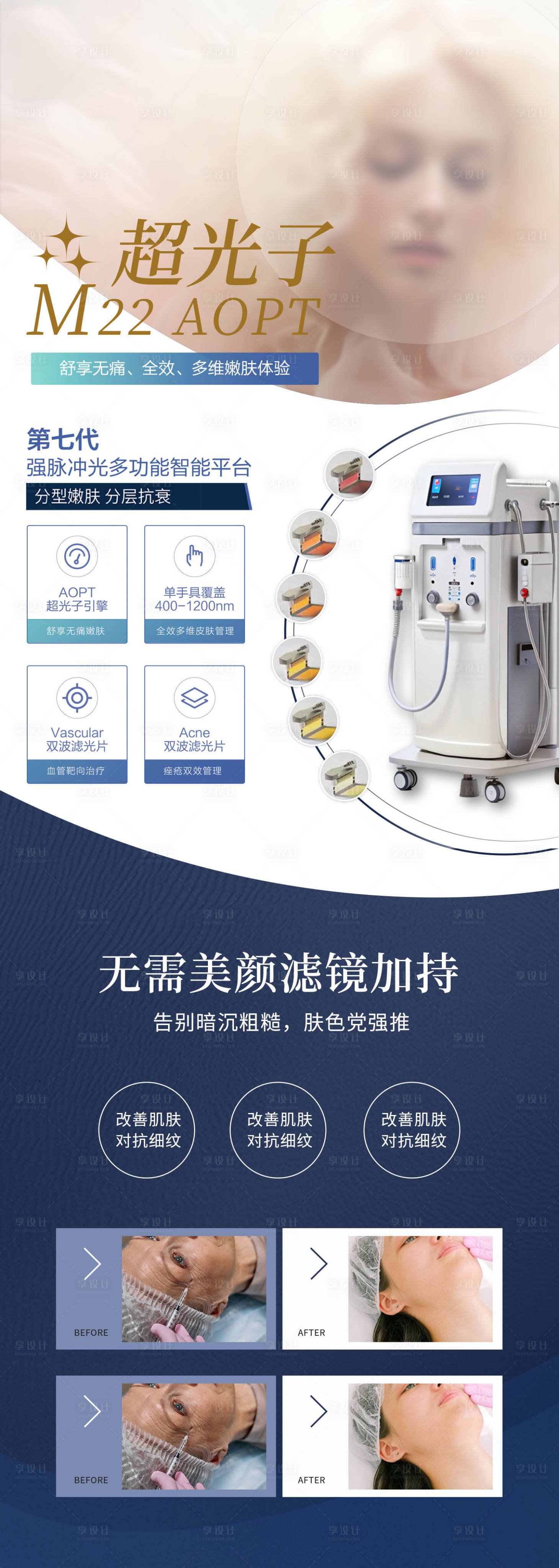源文件下载【享设计】搜索编号：49220028914619382【M22光子嫩肤医美仪器宣传】