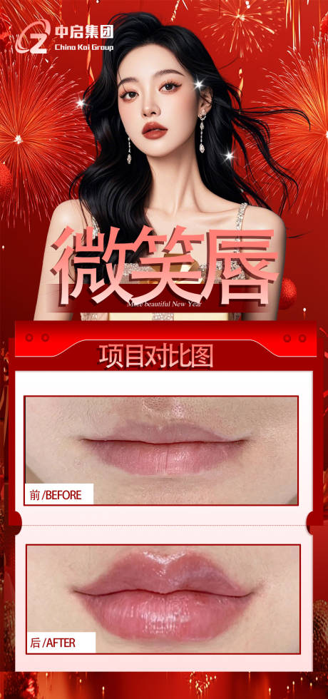 源文件下载【医美微笑唇海报】编号：25440028823218879