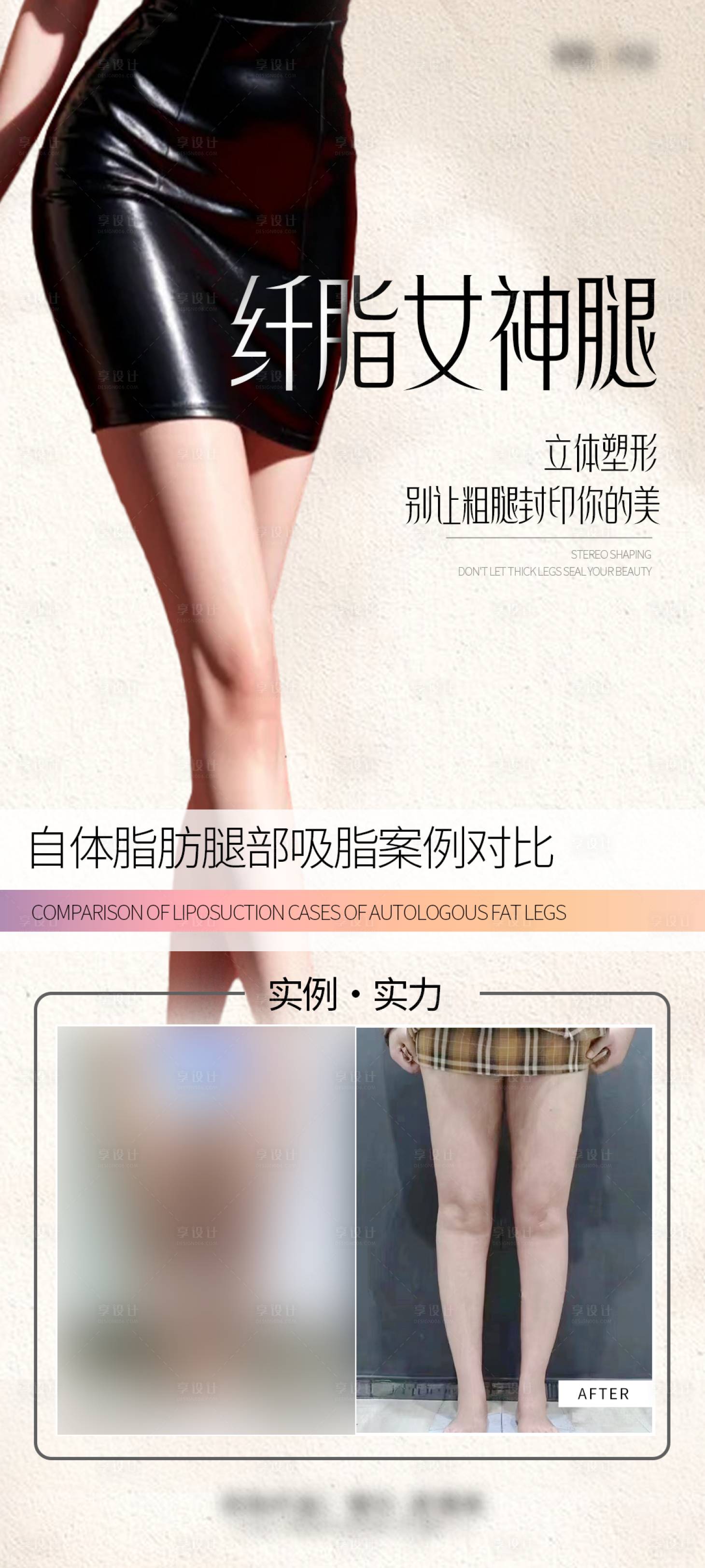 源文件下载【女神腿案例】编号：61670028780324138