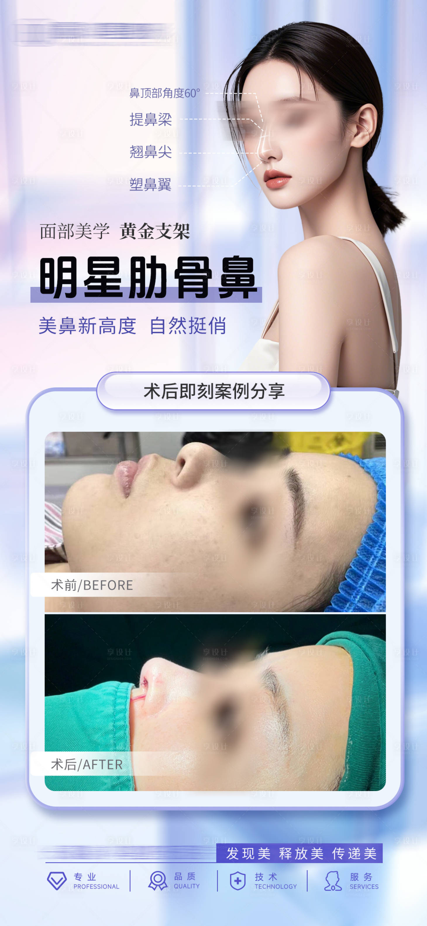 源文件下载【享设计】搜索编号：48130028683349948【肋骨鼻鼻综合案例海报】
