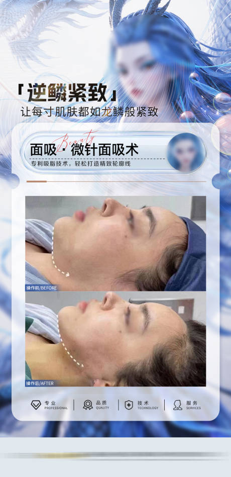 源文件下載【享設計】搜索編號：87190028977007624【醫美案例哪吒敖閏】