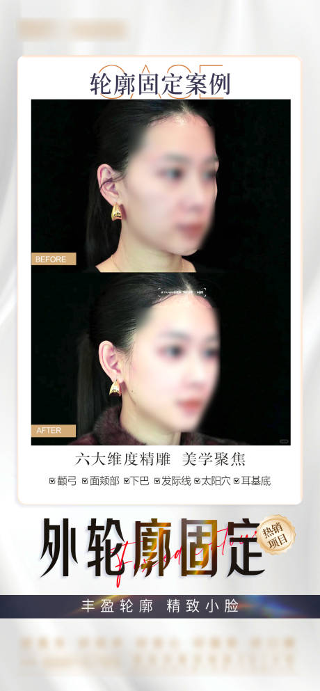 源文件下载【轮廓固定案例海报】编号：37230029028315337