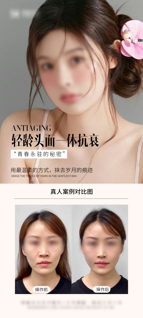源文件下载【抗衰案例海报】编号：92210029051184323