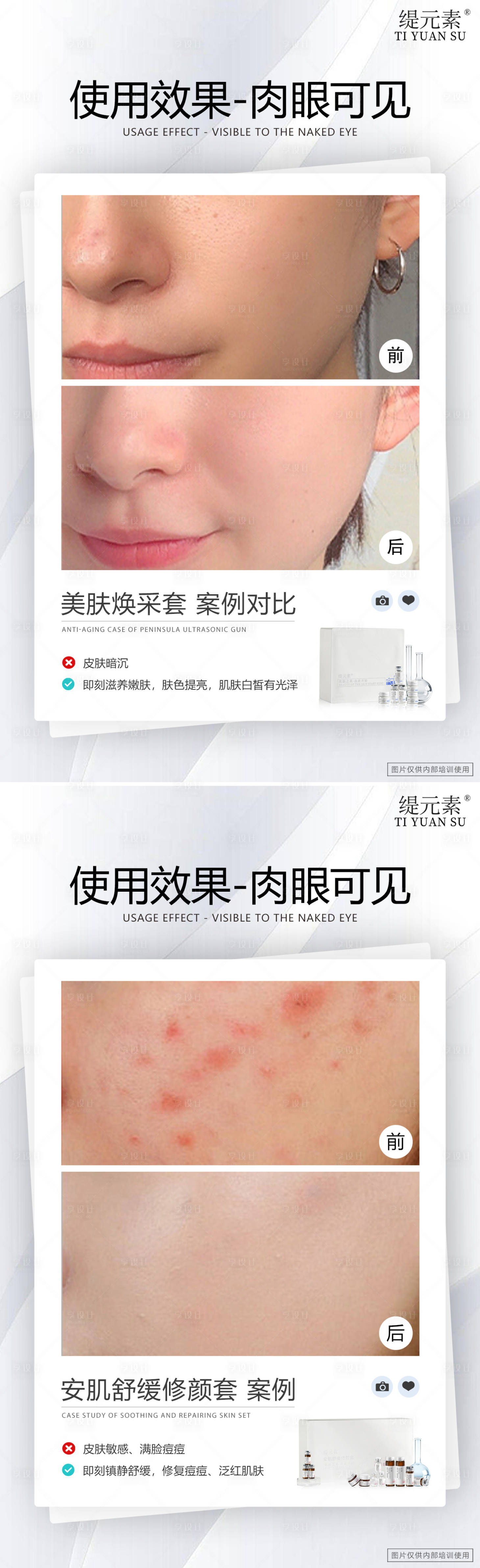 源文件下載【享設(shè)計】搜索編號：17470028818387239【美白修復(fù)對比圖】