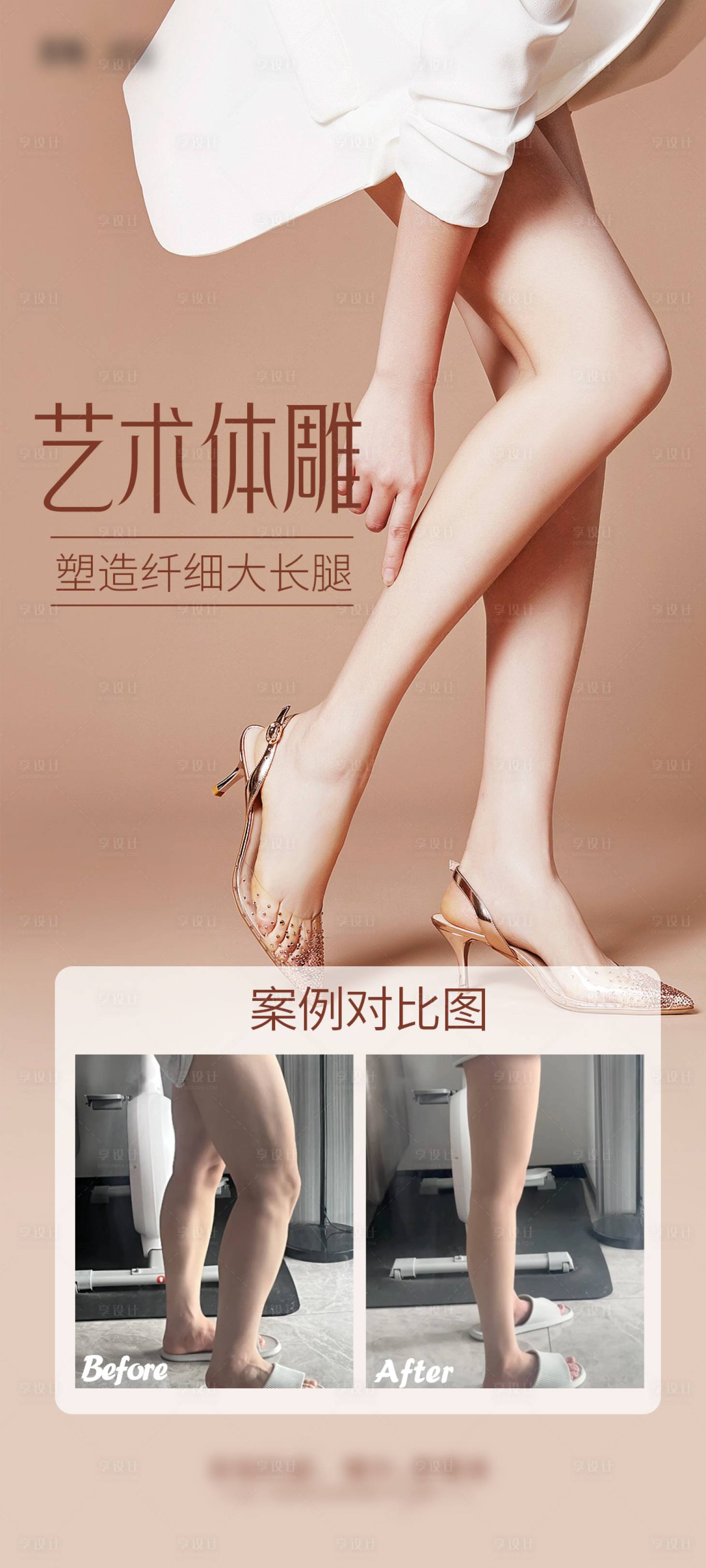 源文件下载【医美细腿海报】编号：67450028971704060