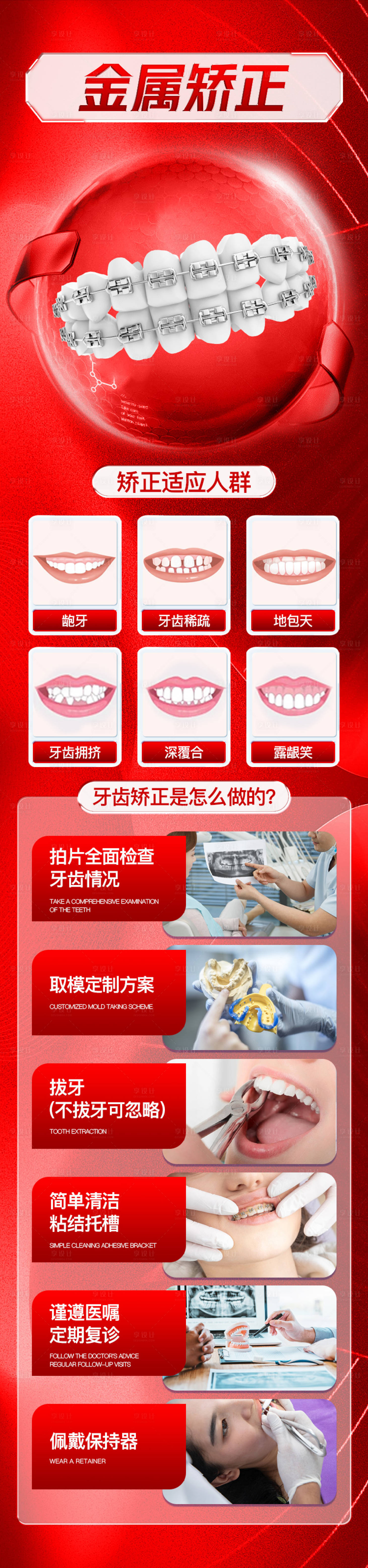 源文件下载【牙齿金属矫正活动长图】编号：93690029030814107