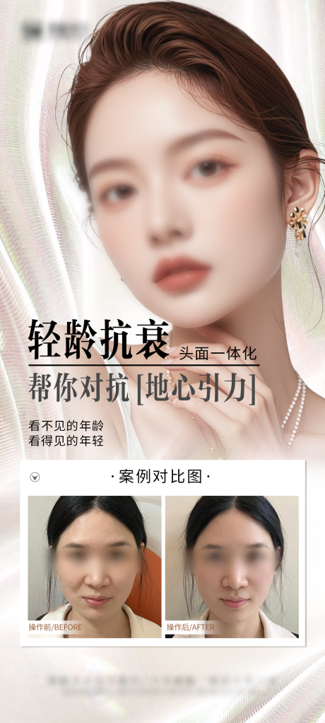 源文件下载【抗衰案例海报】编号：54680028977342914