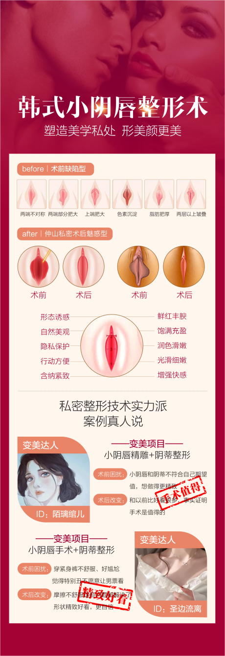 私密整形海报 