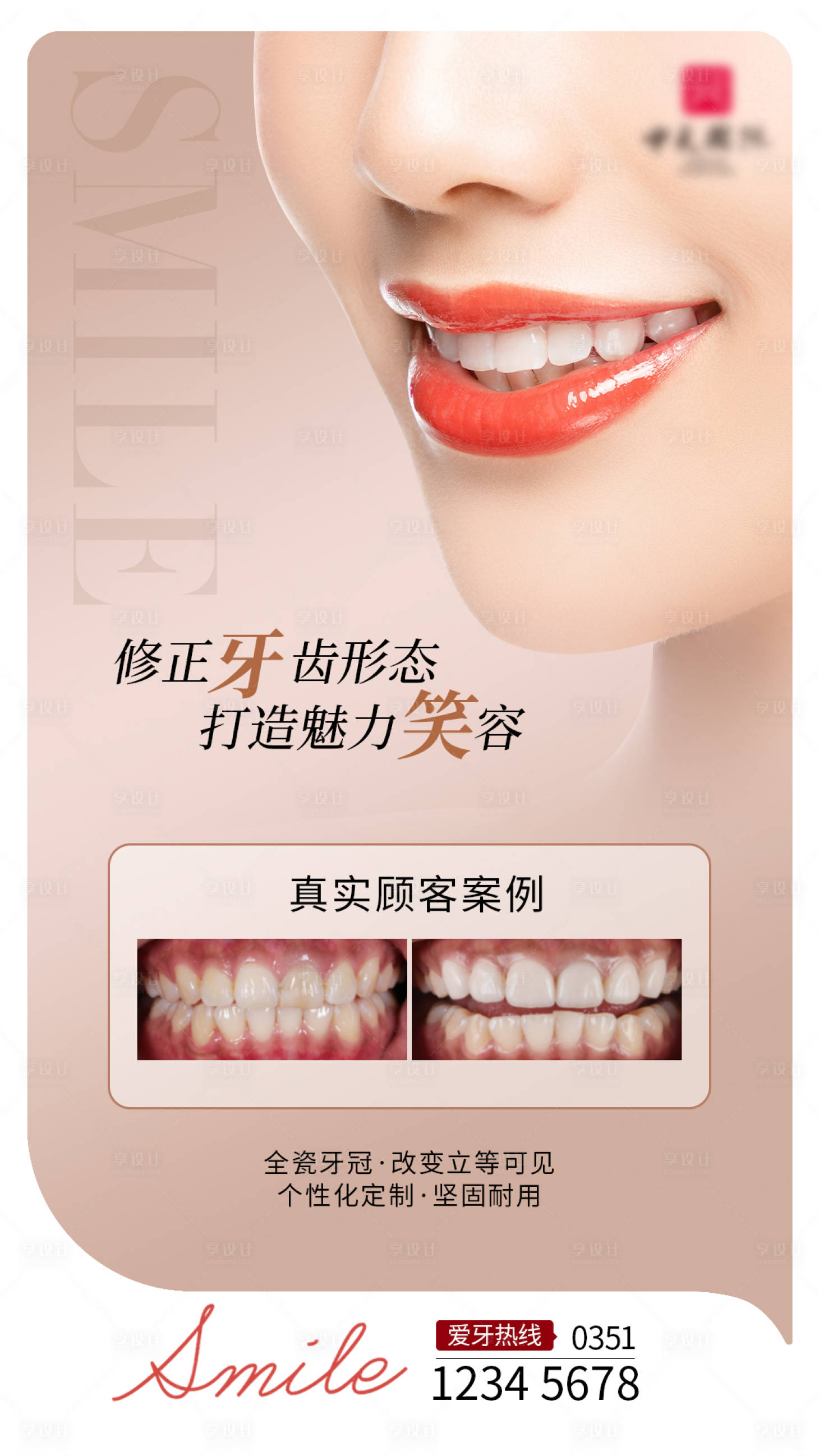 源文件下载【牙齿护理海报】编号：98490028992481478