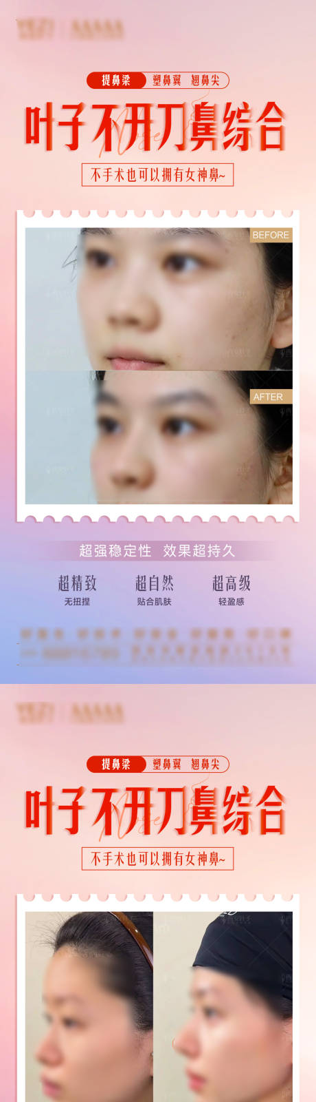 源文件下載【享設計】搜索編號：65630028655178526【隆鼻 】