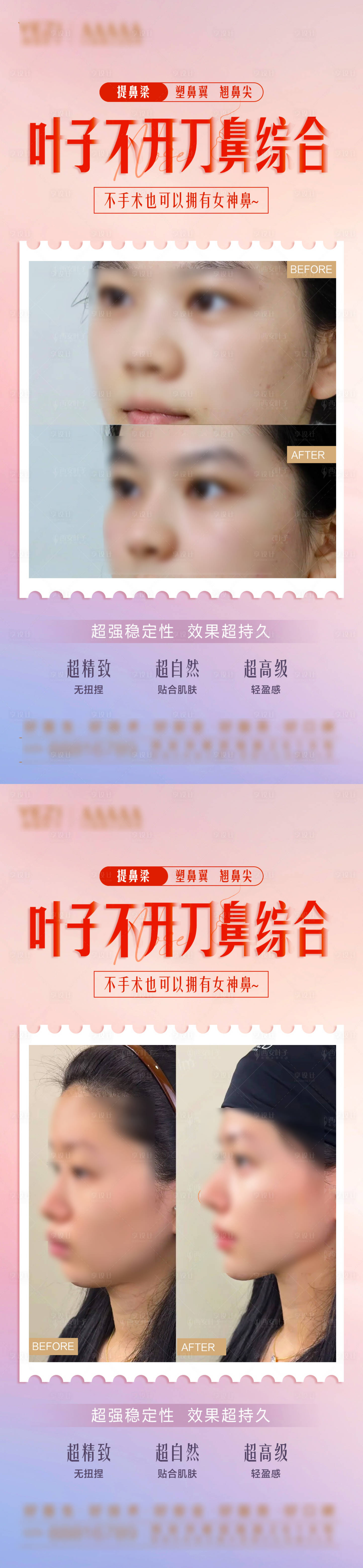 源文件下載【享設(shè)計】搜索編號：65630028655178526【隆鼻 】