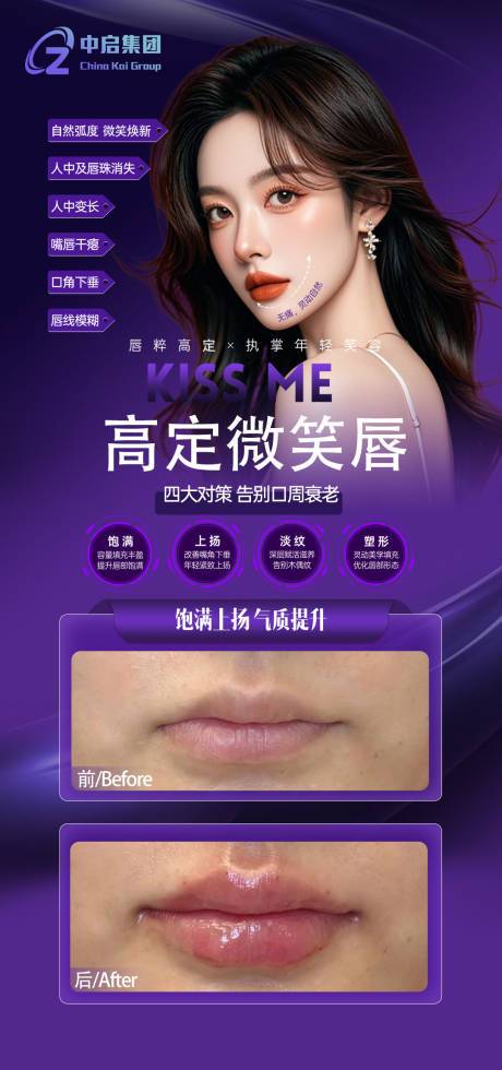 源文件下載【享設計】搜索編號：11510028823079398【醫美微笑唇海報】