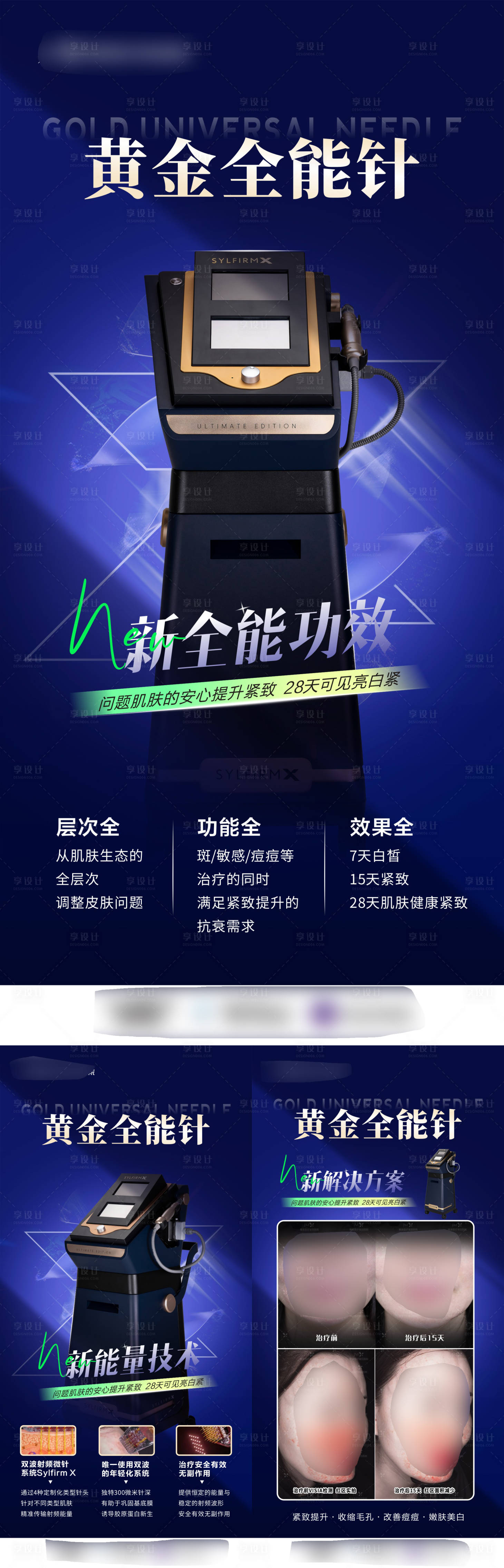 源文件下載【享設計】搜索編號：17460028766198055【醫美儀器特點案例黃金全能針宣傳海報】