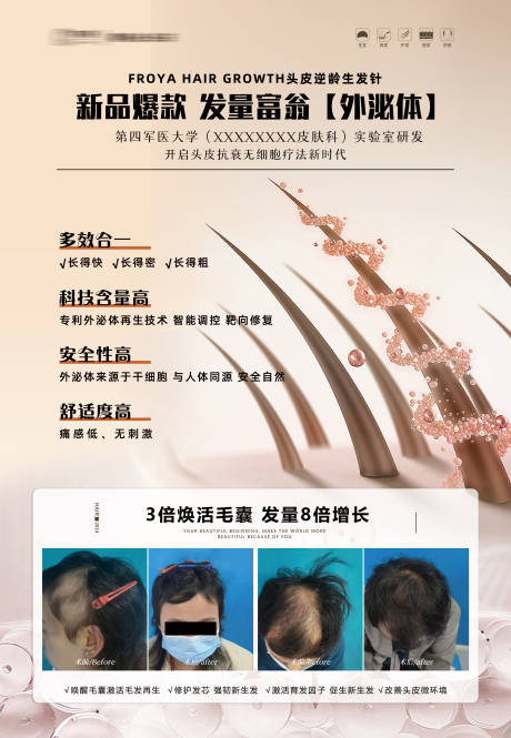 头皮KT版