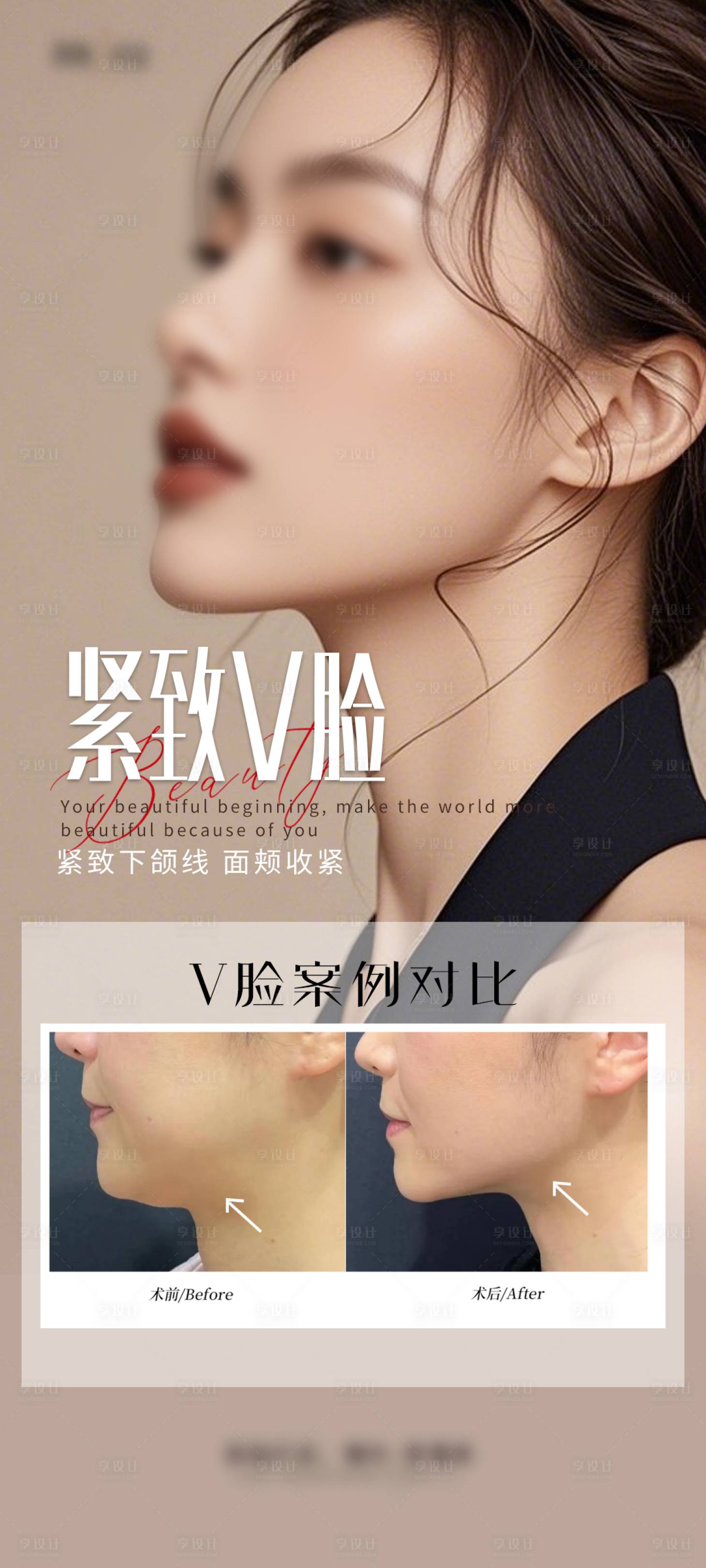 源文件下载【享设计】搜索编号：68180028840573451【紧致v脸案例海报】