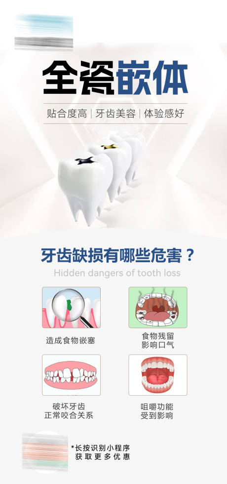 口腔全瓷嵌体海报