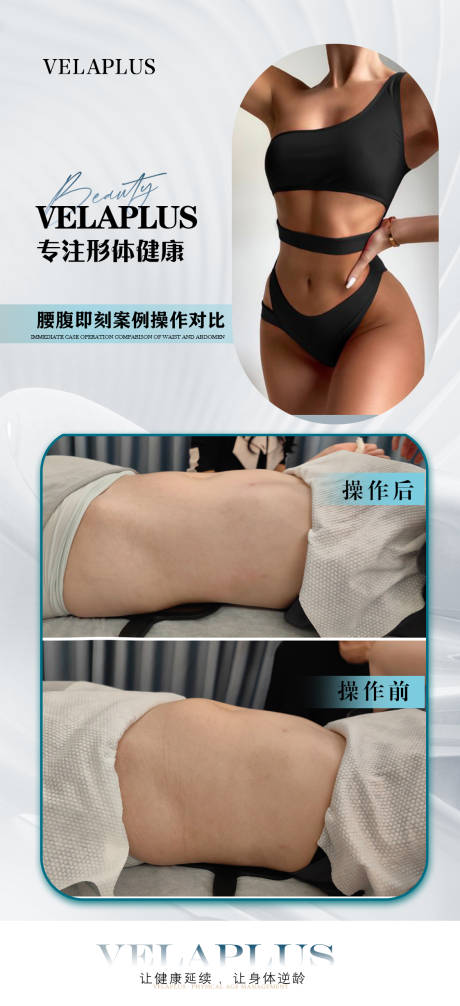 源文件下载【腰腹前后对比】编号：90610028625926668