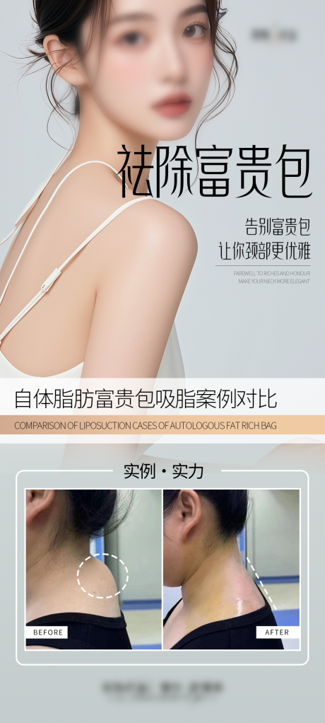 源文件下載【享設計】搜索編號：98160028758946774【祛除富貴包案例海報】