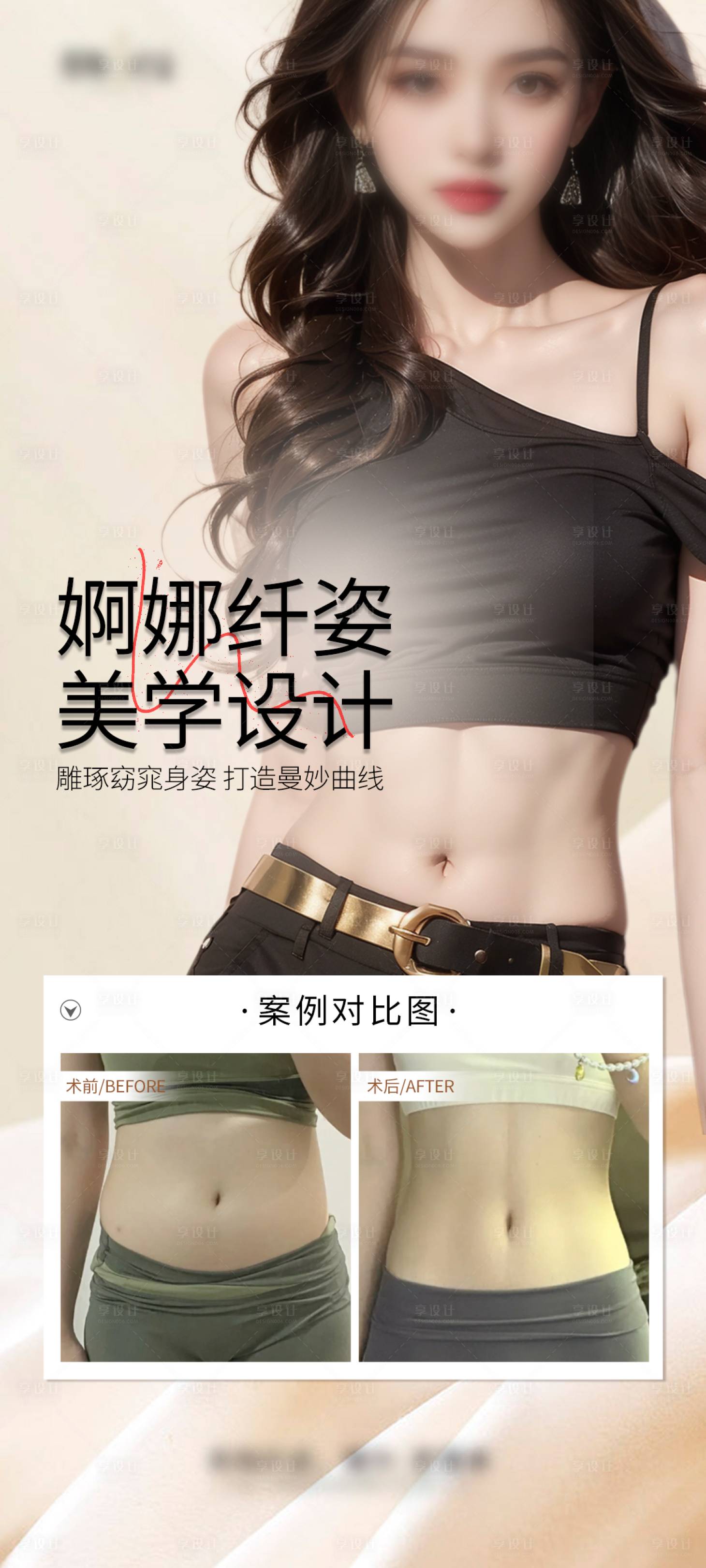 源文件下载【医美腰腹案例海报】编号：87060028918372866