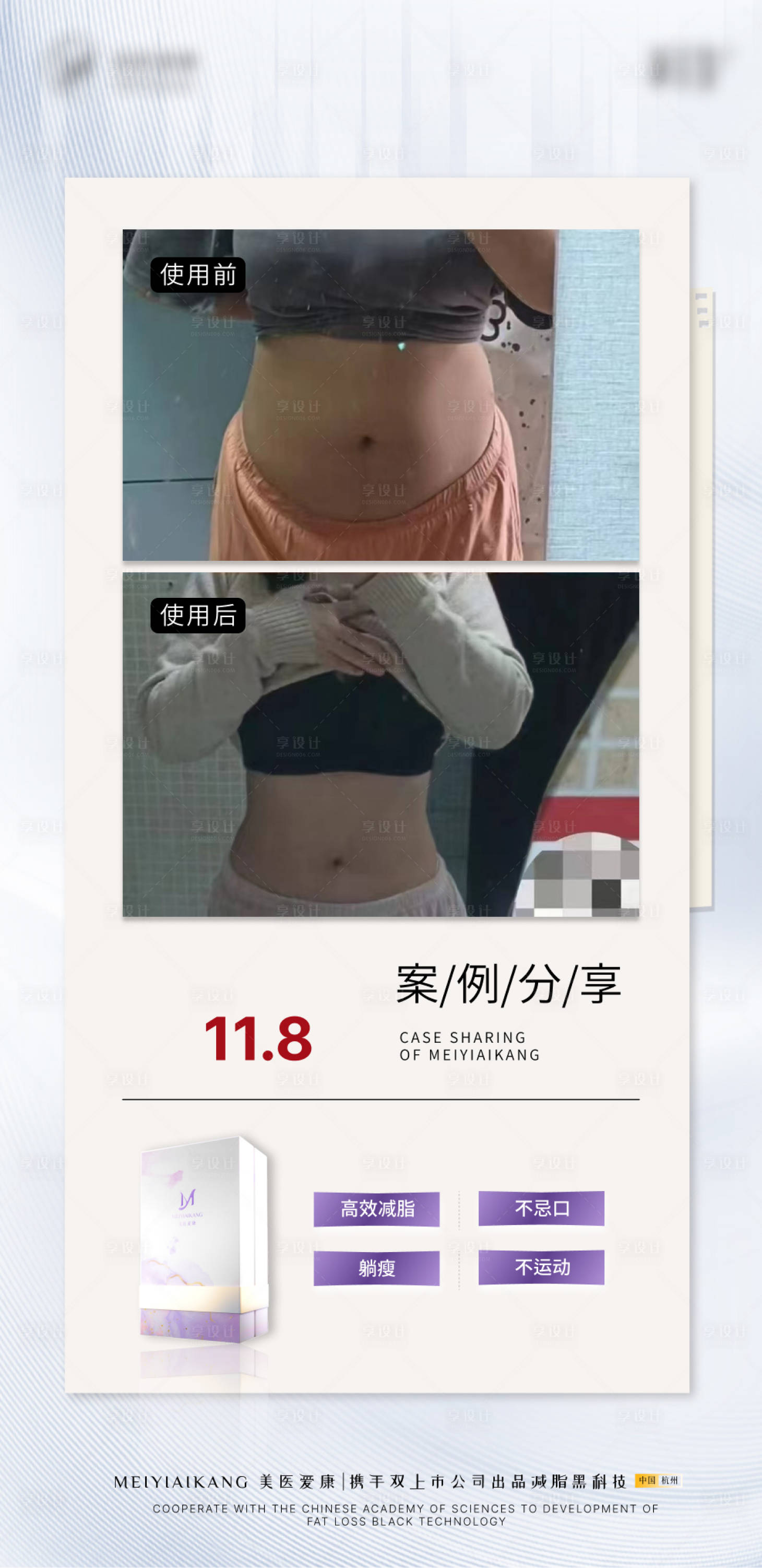 源文件下載【享設計】搜索編號：53530028727395474【吸脂減肥塑體雕塑形醫美海報美體案例】