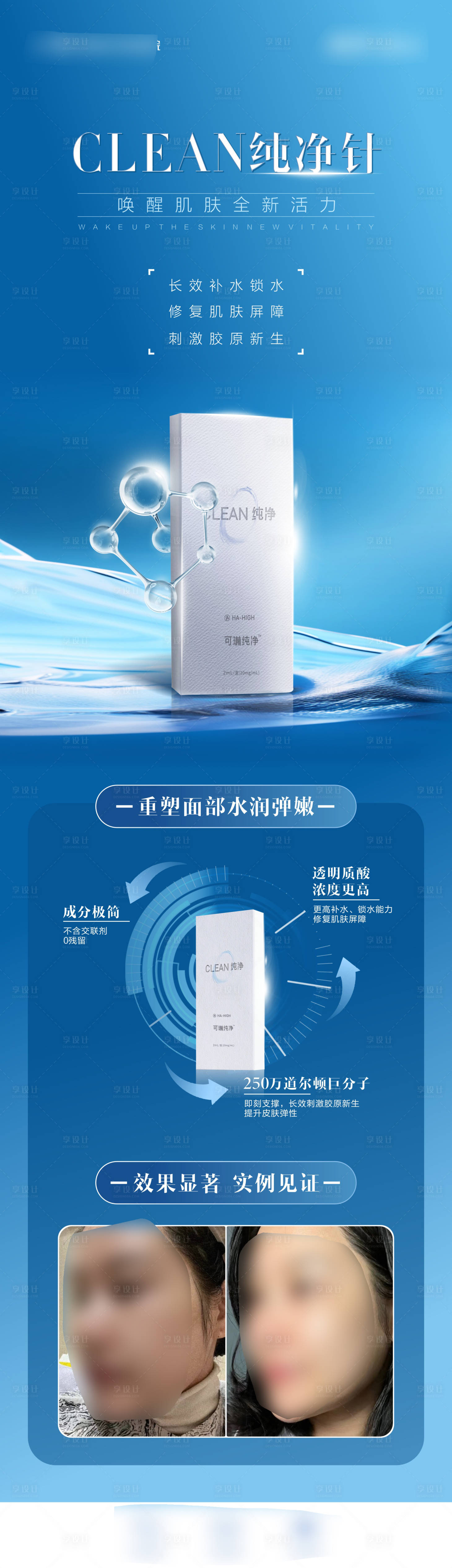 源文件下載【享設(shè)計(jì)】搜索編號(hào)：98150028767262206【醫(yī)美產(chǎn)品案例宣傳海波】