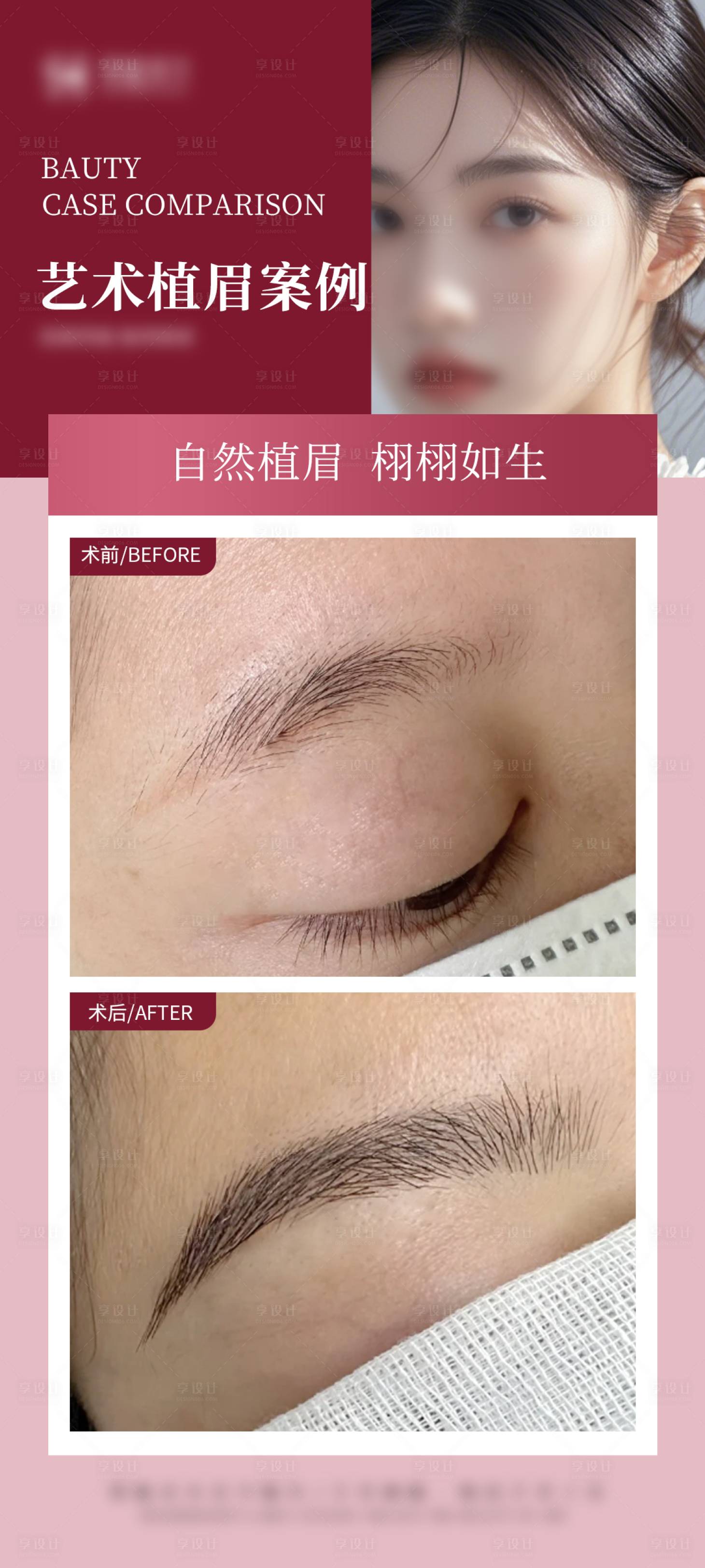 源文件下载【艺术植眉案例】编号：94960028641182674