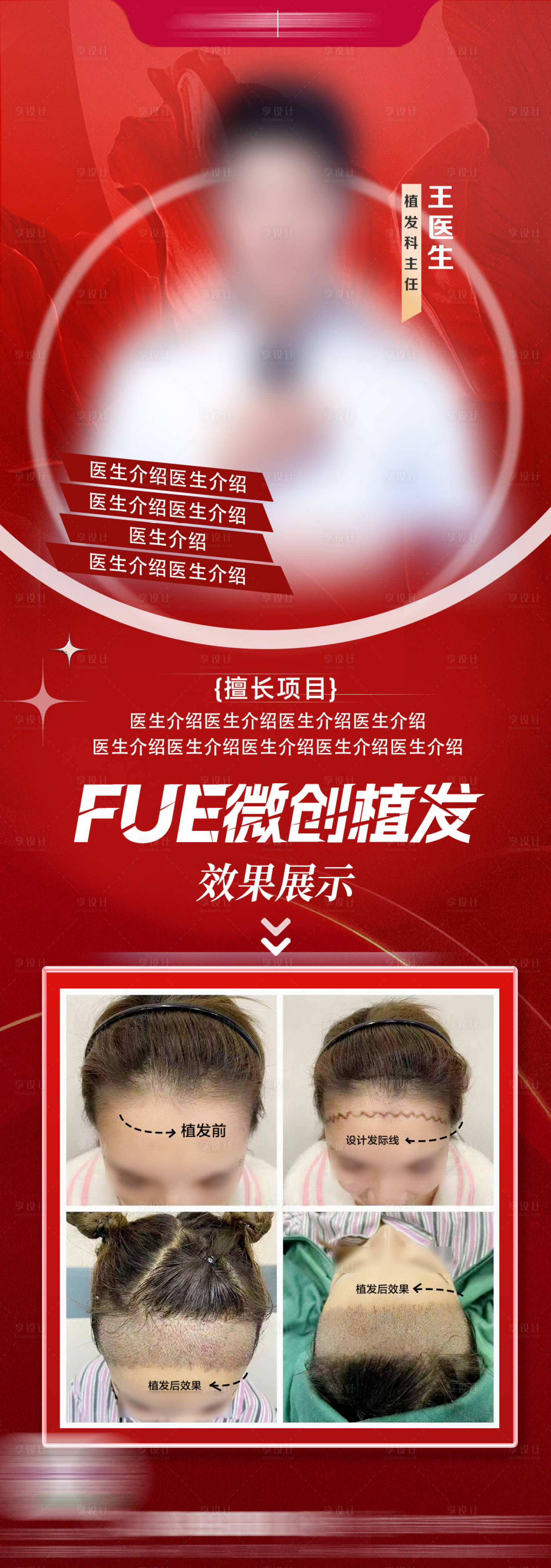 源文件下载【享设计】搜索编号：52030028956481029【fue植发医生海报】