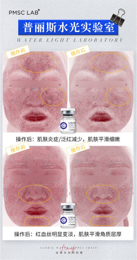 源文件下载【享设计】搜索编号：65160028947183050【美业水光案例海报】