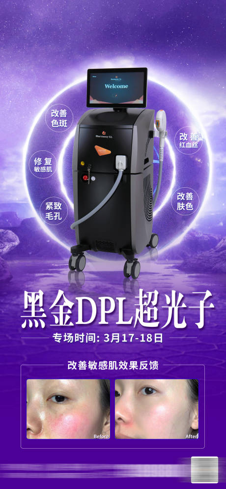 黑金超光子