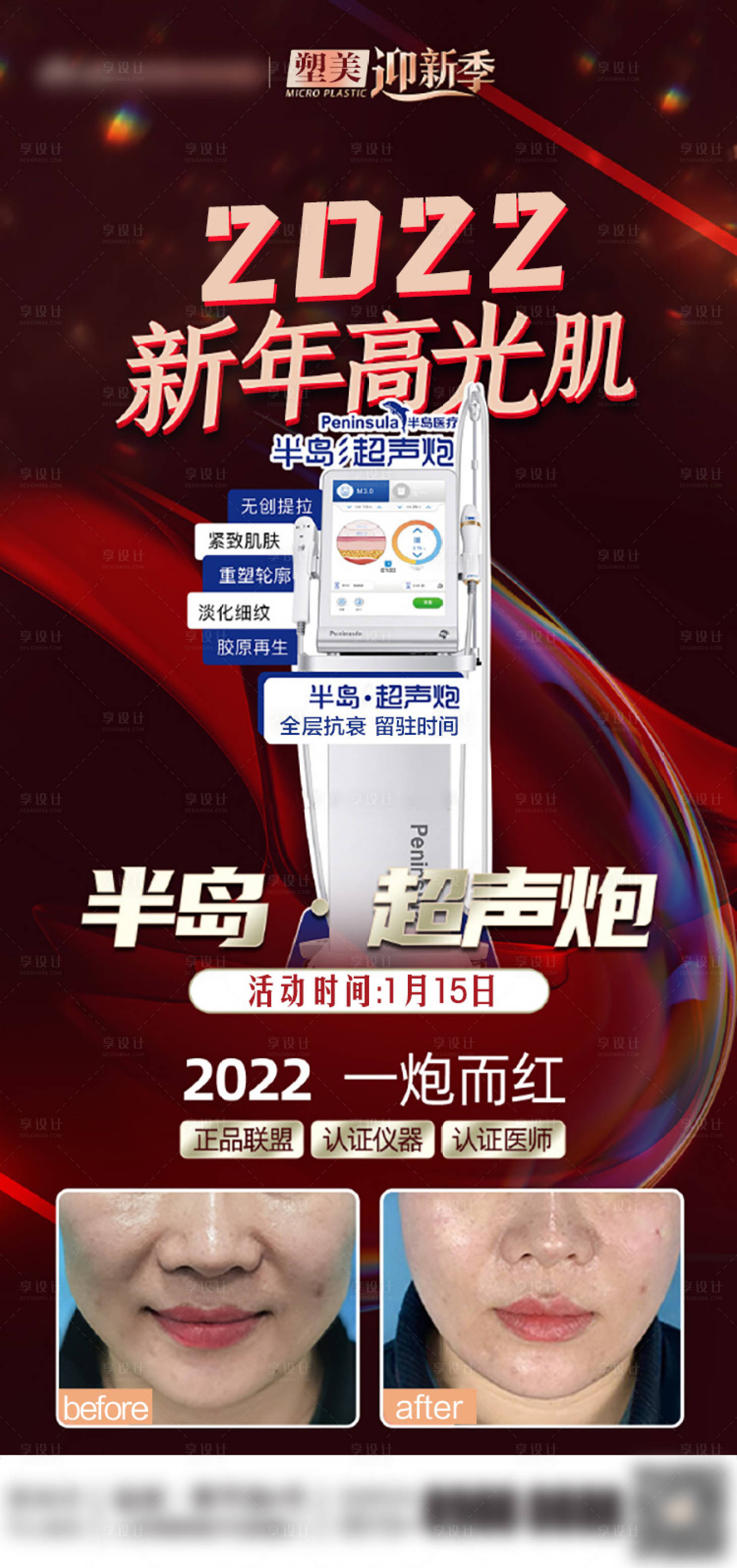 源文件下载【享设计】搜索编号：69170028817169798【超声炮】