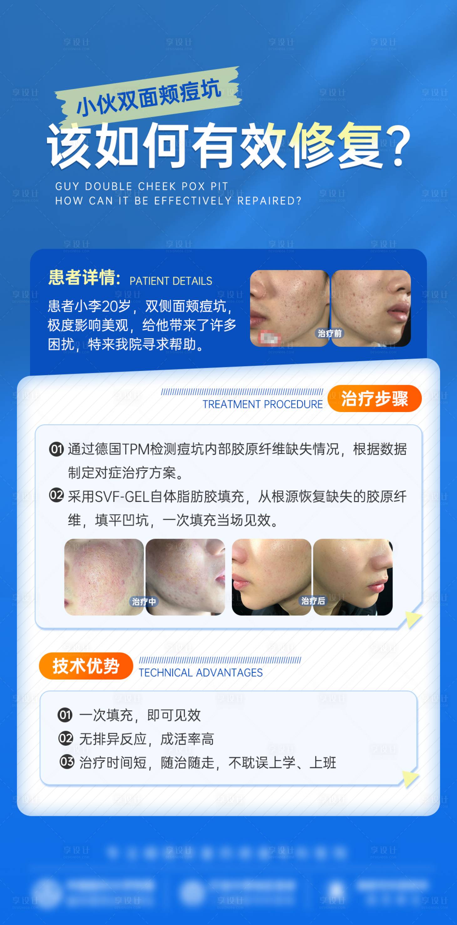 源文件下载【享设计】搜索编号：23270028605966493【科普案例详情介绍海报】