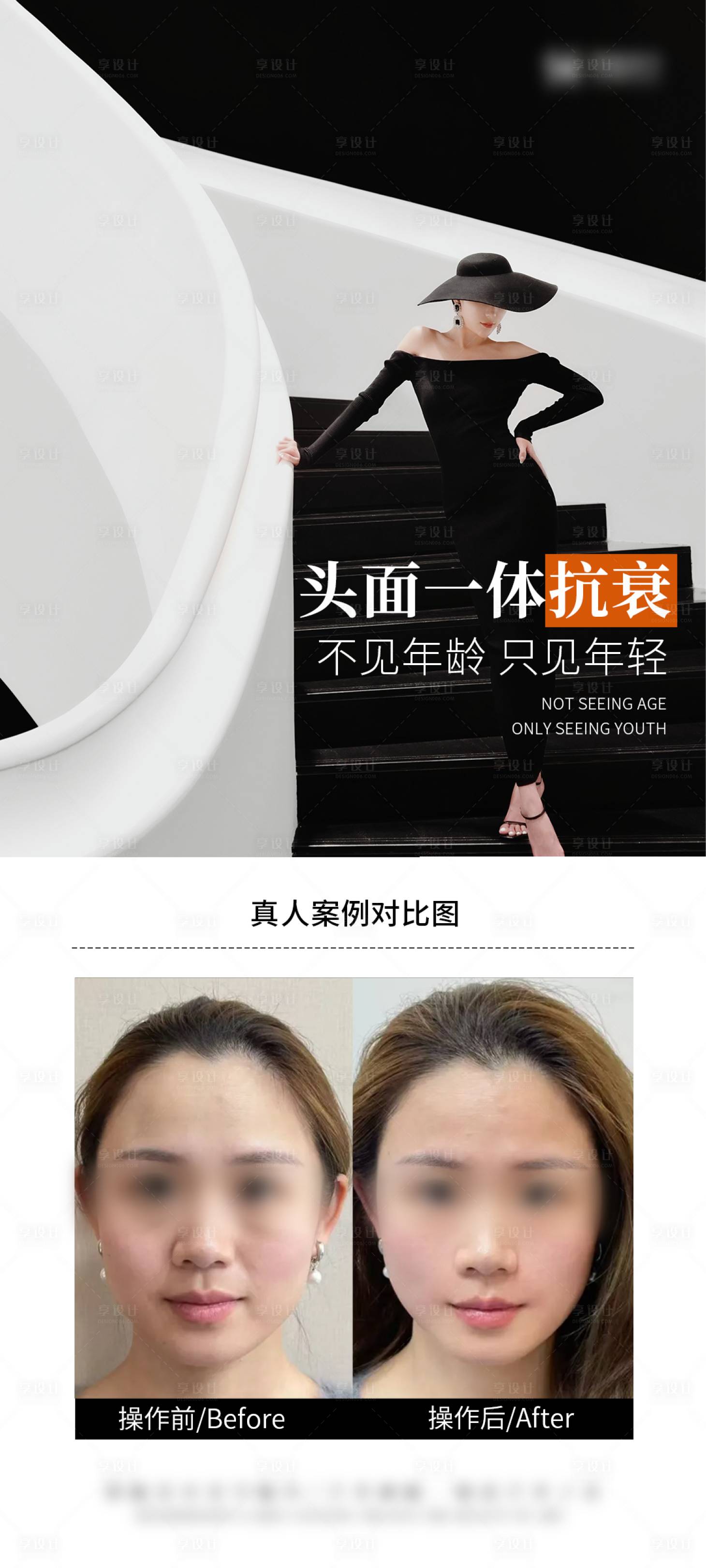 源文件下載【享設計】搜索編號：63680028977101812【抗衰案例海報】