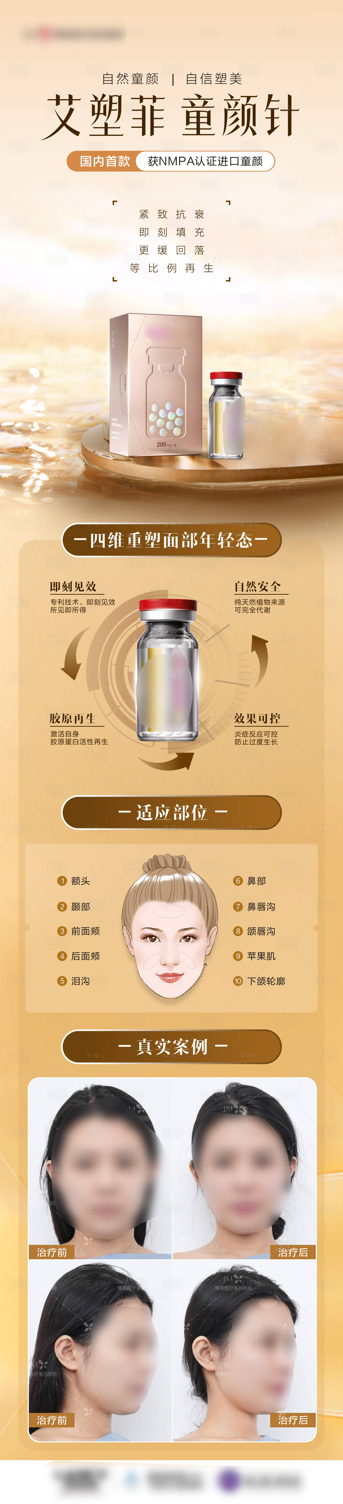 源文件下載【享設計】搜索編號：91210028674796765【醫美艾塑菲產品宣傳長圖海報】