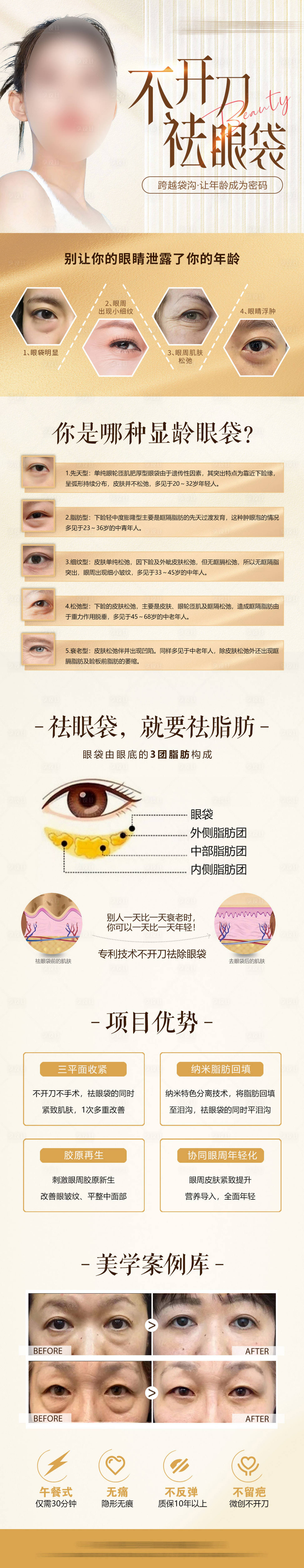 源文件下载【医美整形不开刀祛眼袋品宣长图】编号：31910028700426162