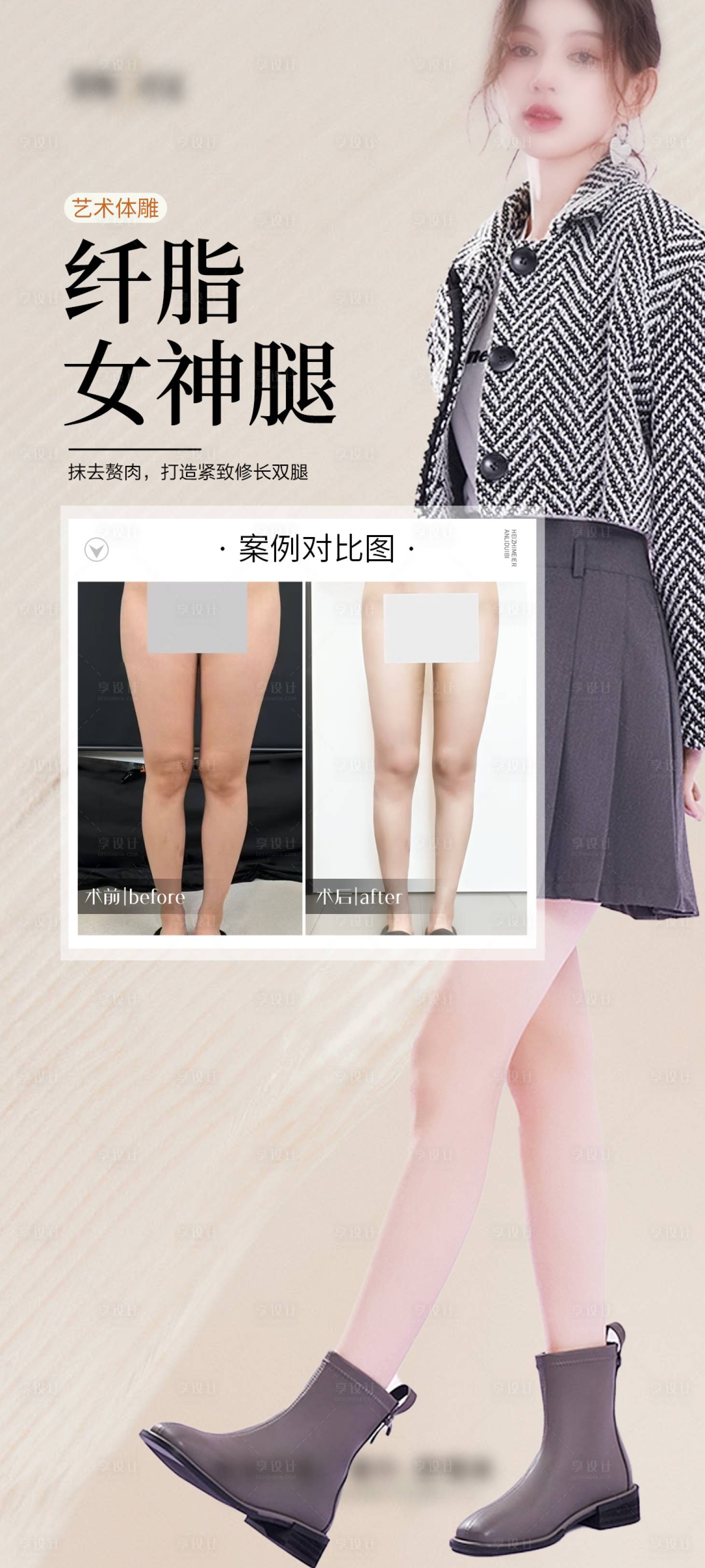 源文件下載【享設計】搜索編號：70670028971579359【醫美長腿案例海報】