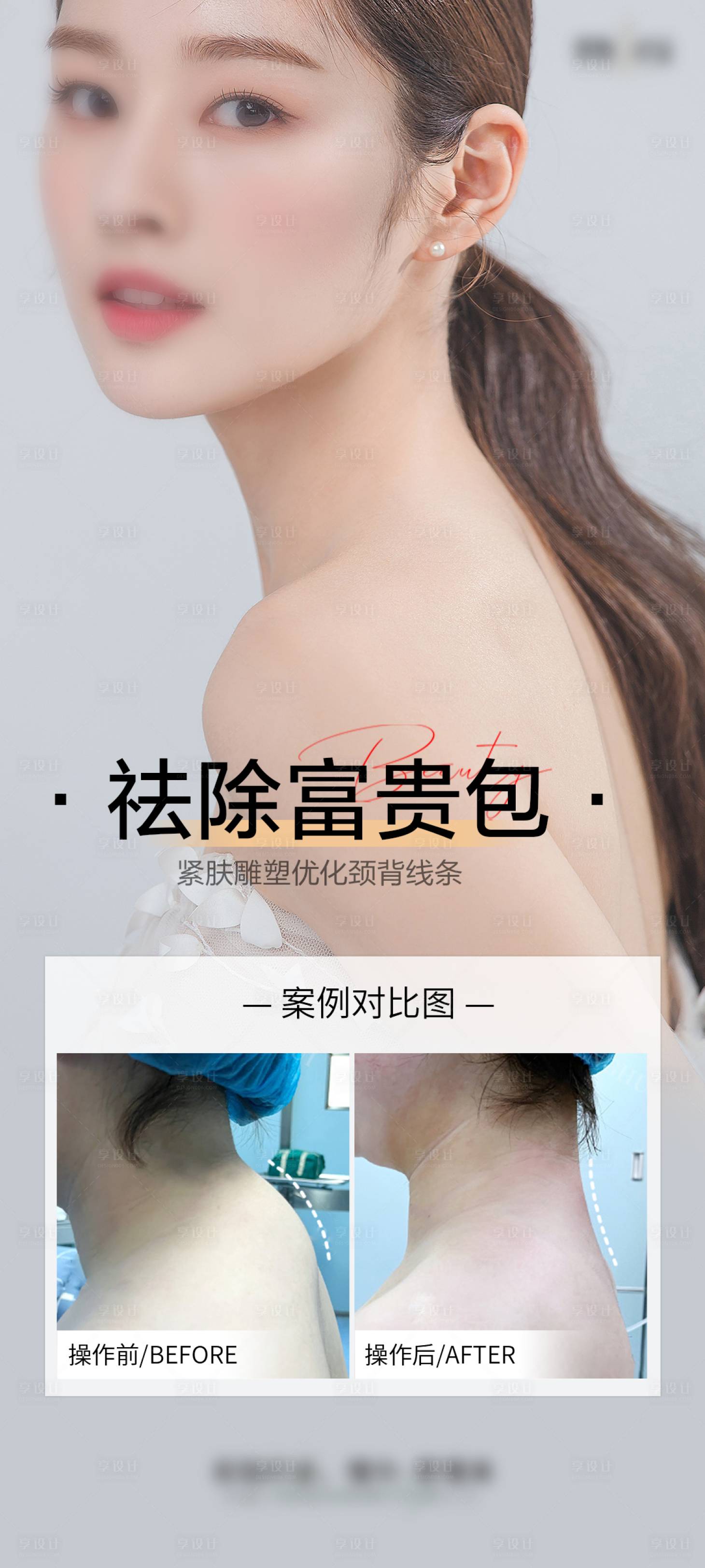 源文件下載【享設計】搜索編號：93930028998198050【祛除富貴包案例海報】